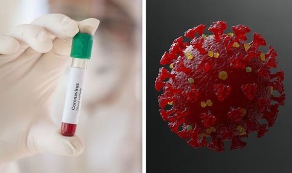新冠病毒以痊癒者血漿用來治療是一個可行的途徑但效果未知。 圖片來源：DailyExpress