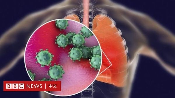 新冠病毒特性像流感易傳染，像SARS據殺傷力。 圖片來源：BBC